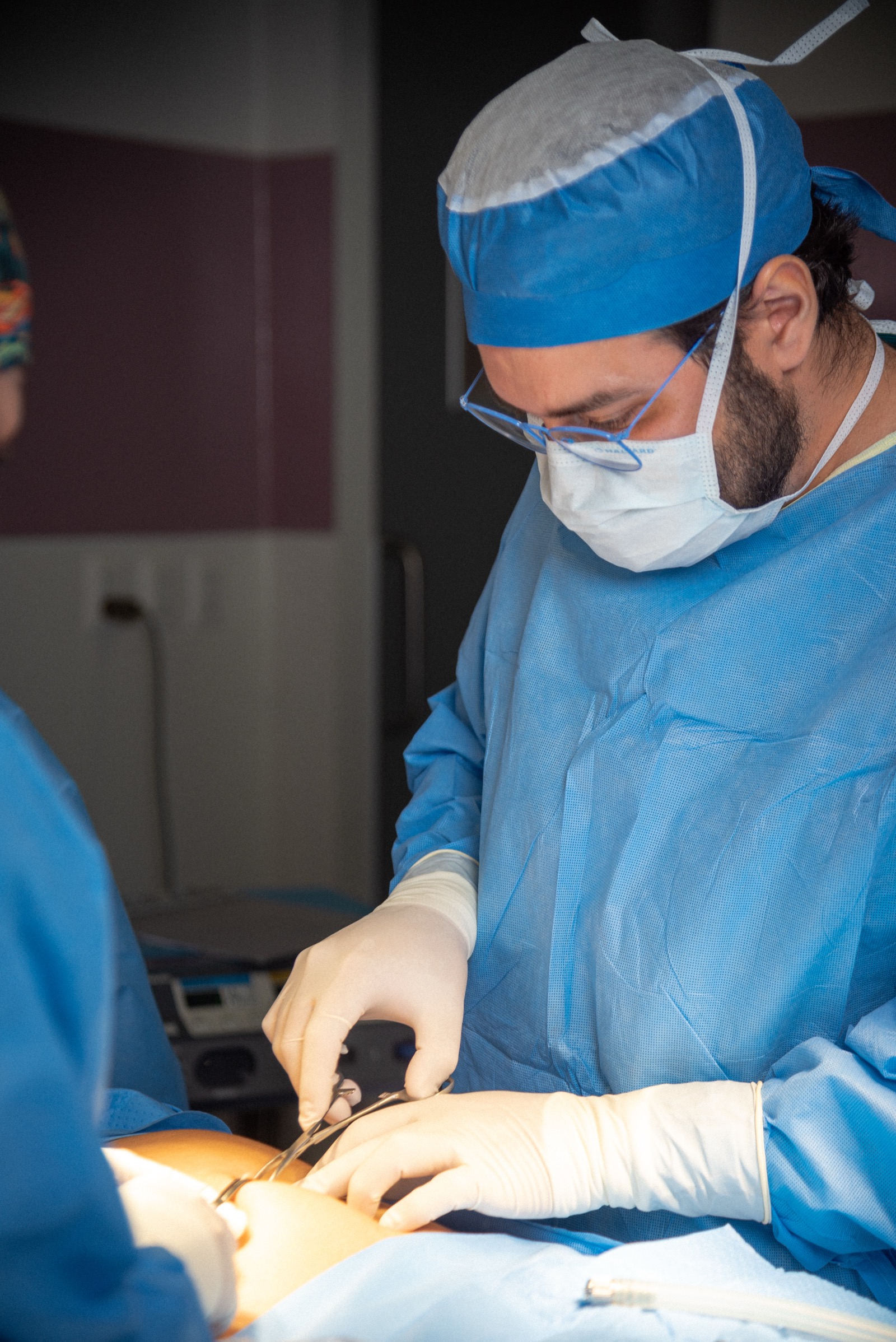 Reparación abierta de hernia umbilical